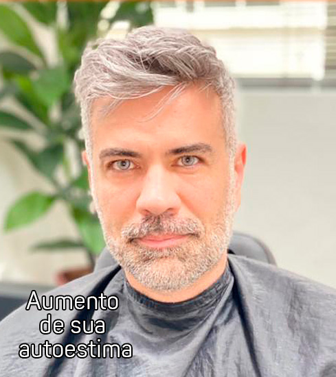 Protese-Capilar-masculino